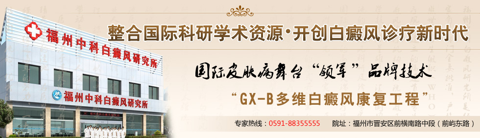 福州中科白癜风研究所