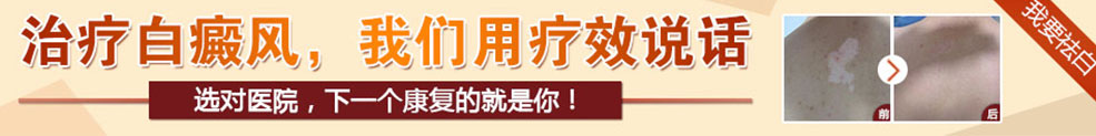 福州白癜风医院
